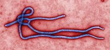 Описание: 220px-Ebola_virus_virion