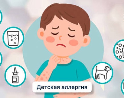 Аллергия у детей