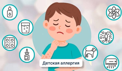 Аллергия у детей
